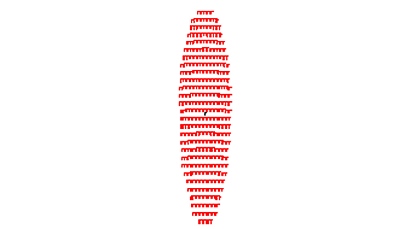 单纯散光